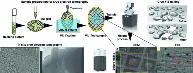 Cryo electron tomography workflow and representative micrographs