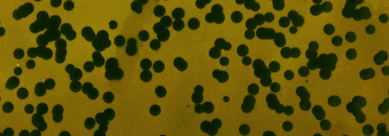Corynebacterium phage image