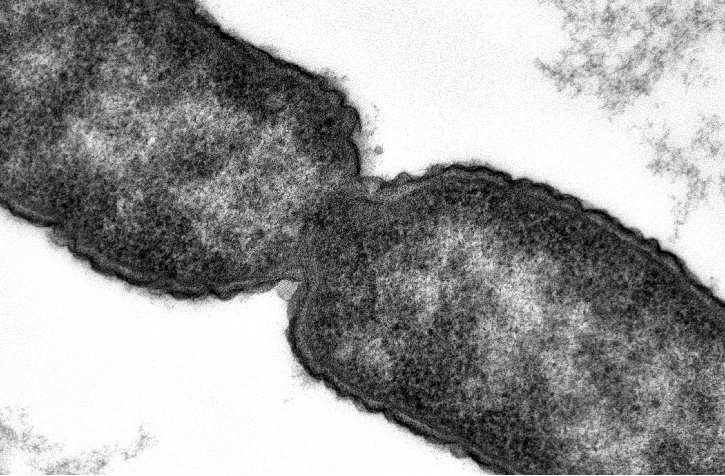 Pseudomonas TEM
